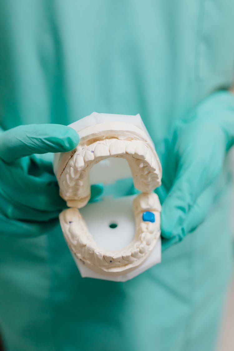 A Dentist Holding A Dental Cast