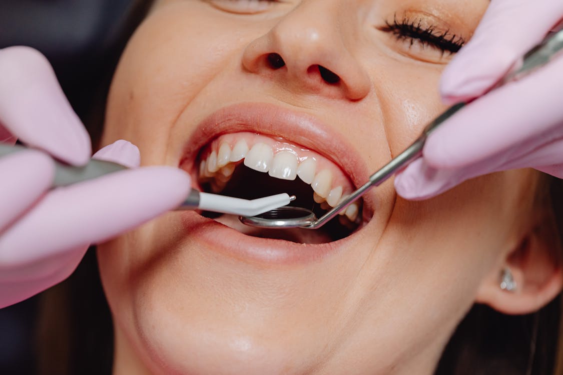 Free  Opened Mouth Woman During Dental Treatment Stock Photo