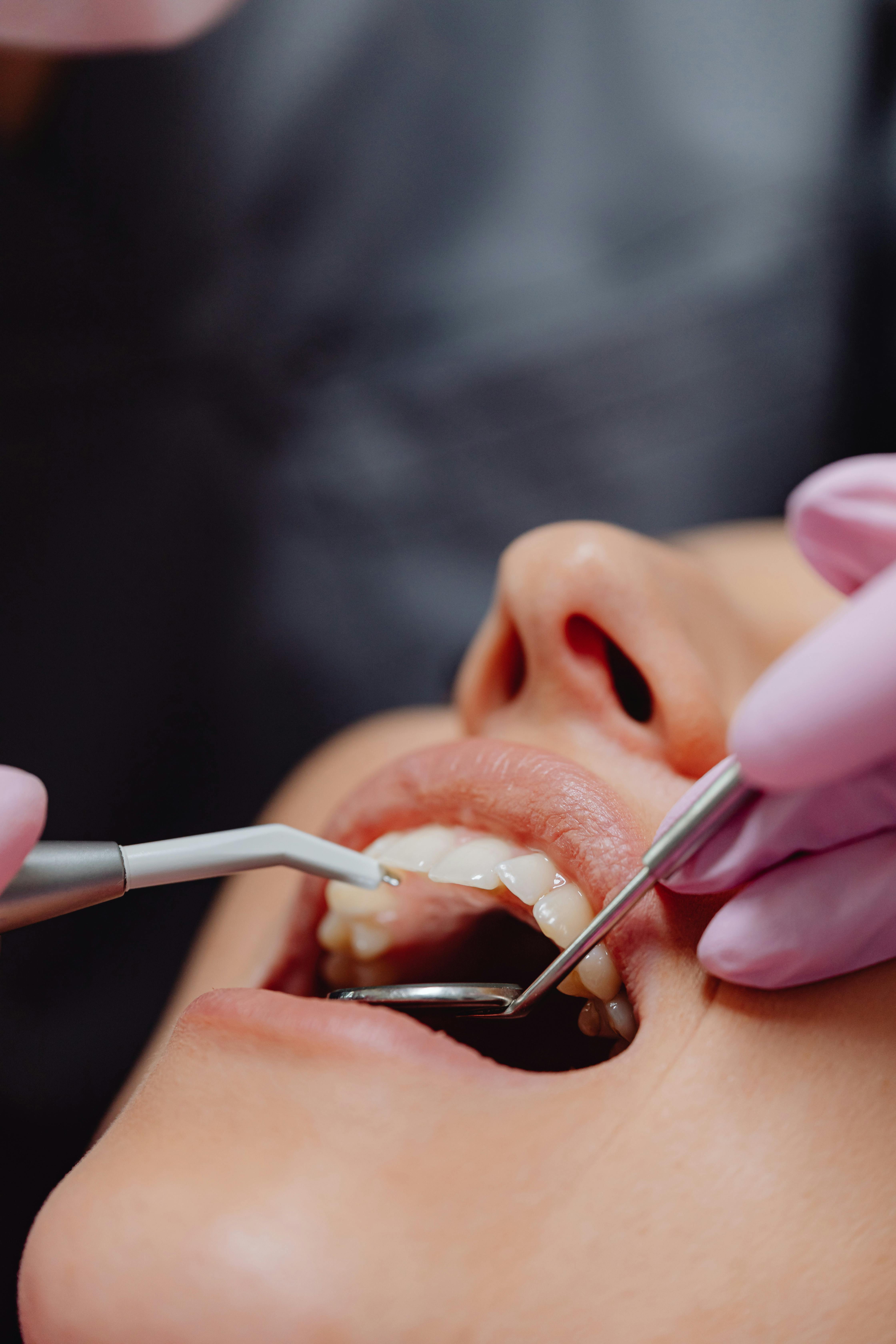 A Patient Undergoing a Dental Procedure · Free Stock Photo, image size:4480x6720