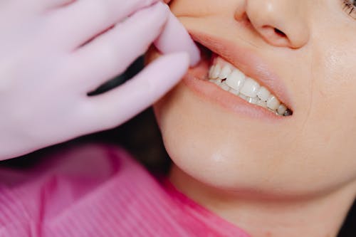
A Person Wearing Latex Gloves Checking a Woman's Teeth