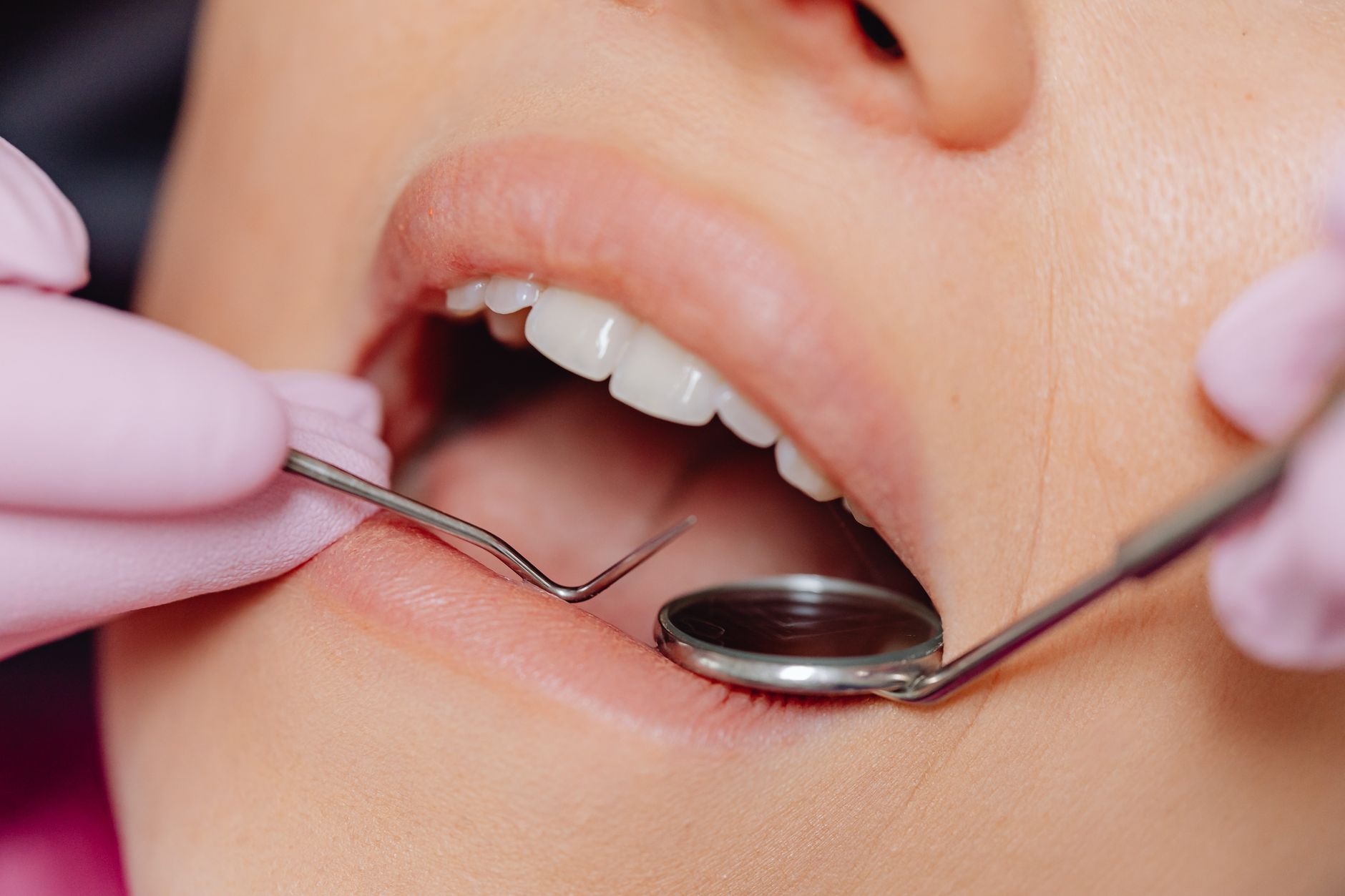 Losing a Tooth? Exploring Your Options for Replacement