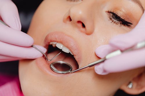 Free Close-Up Photo of a Woman Getting a Dental Check-Up Stock Photo