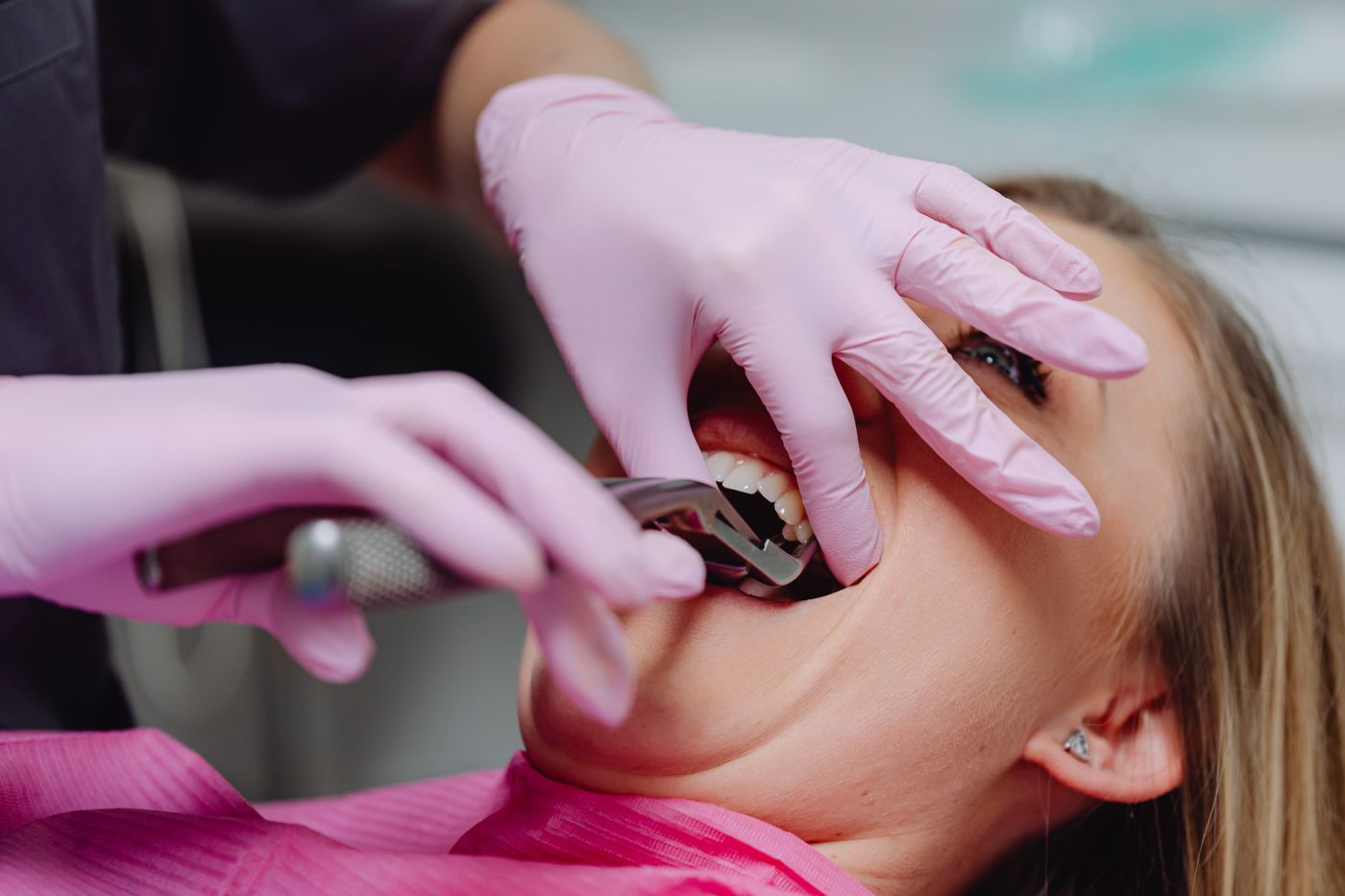 Dental professional performing a controlled tooth extraction