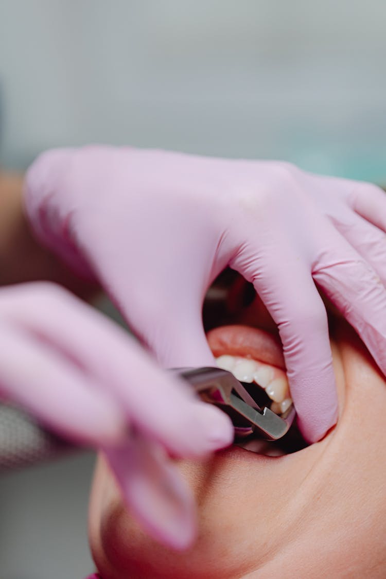 Photograph Of A Person Getting A Dental Check Up