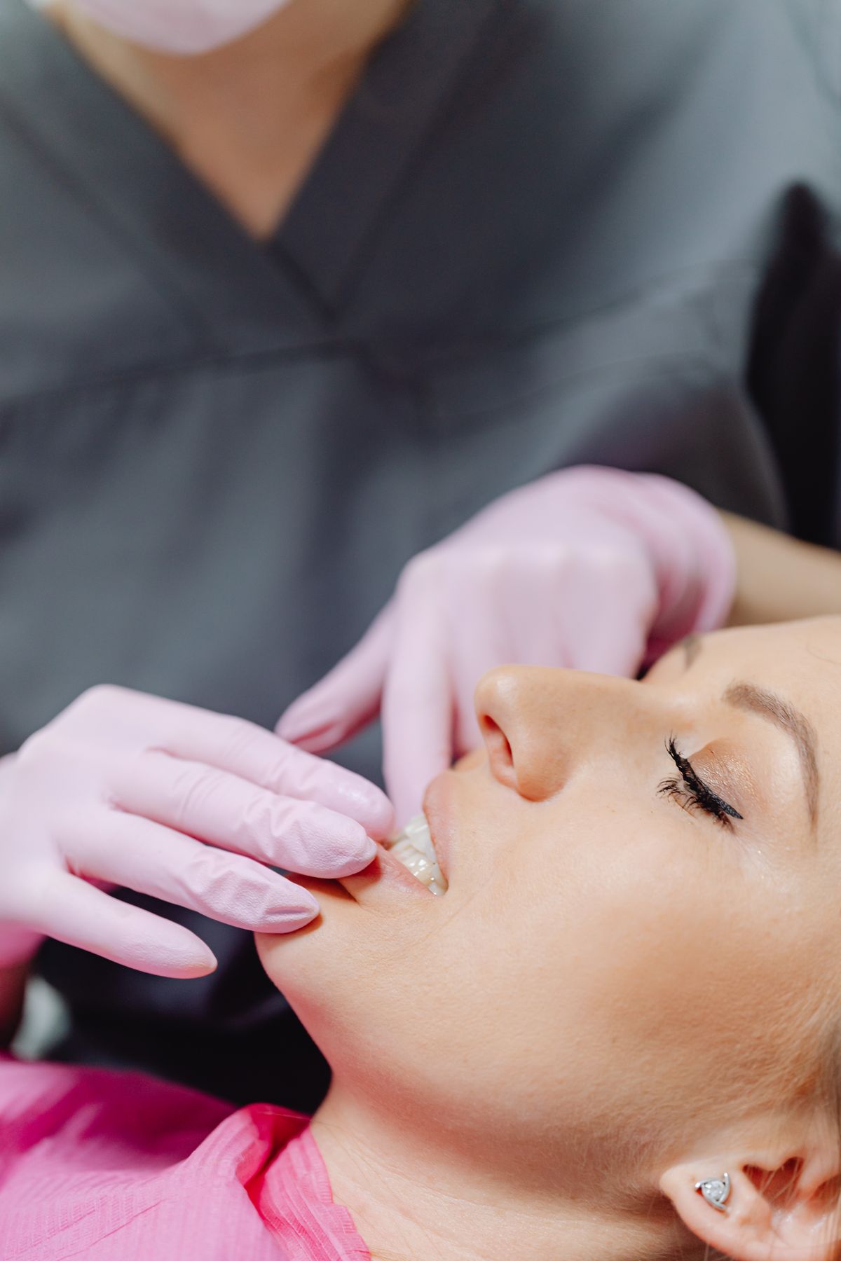 Sorriso natural apos reabilitacao estetica