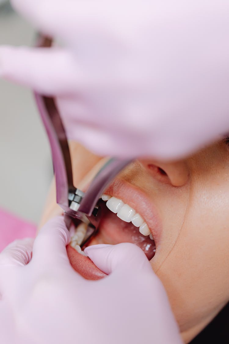 A Patient Undergoing A Tooth Extraction