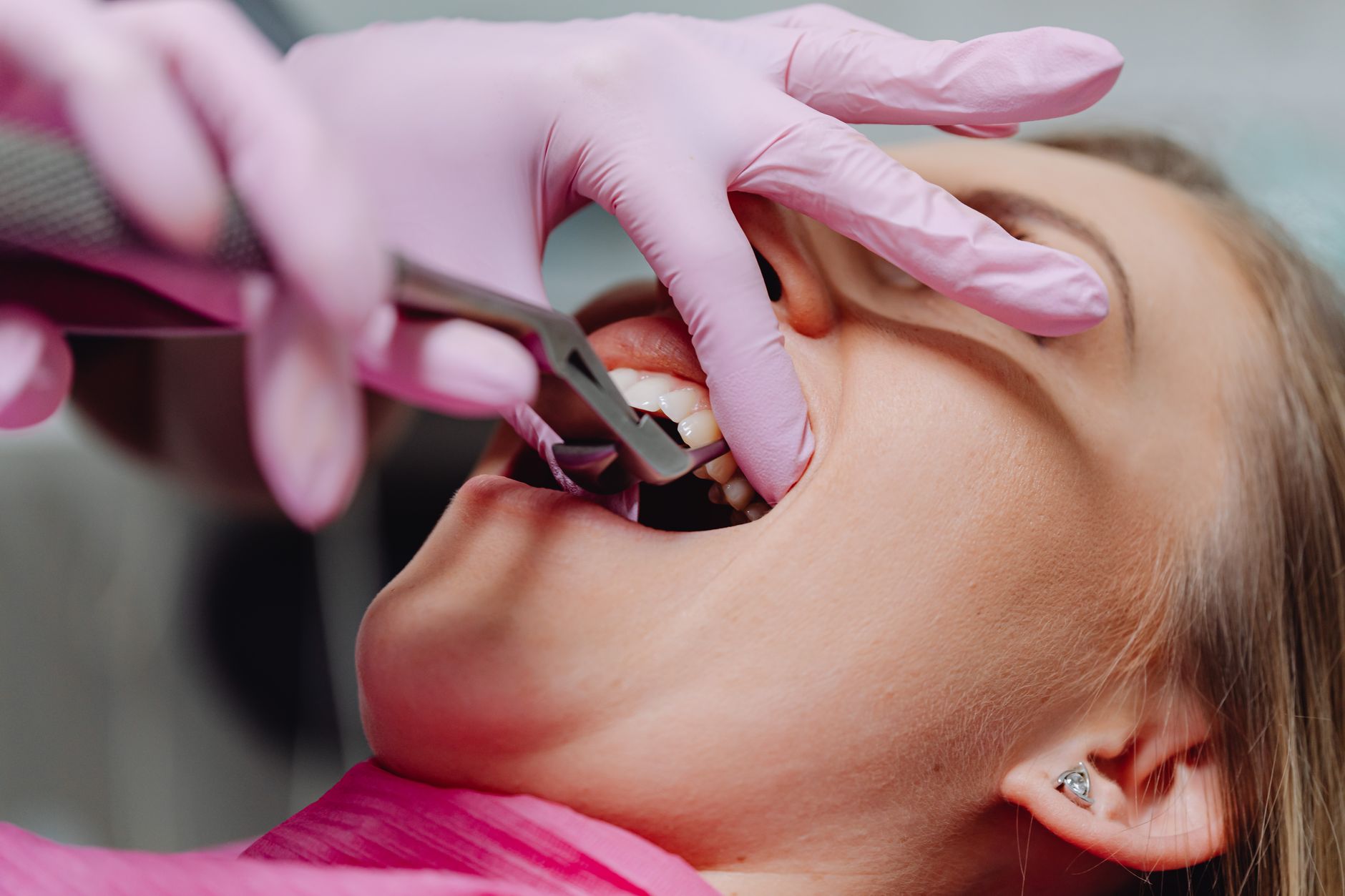 Oral Surgery in a Dentistry setting — illustrative photo for Teston, ON guide. Oral Surgery in a Dentistry setting — illustrative photo for Teston, ON guide.