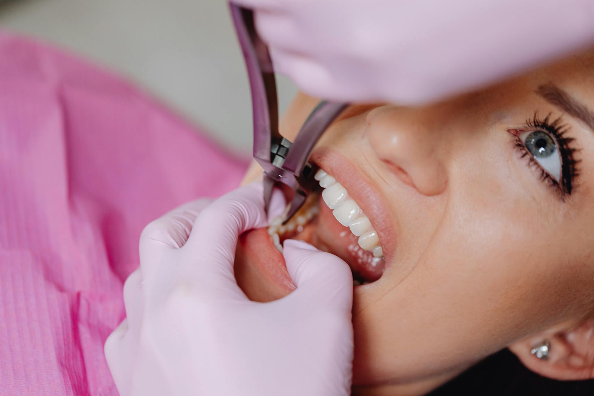 Close up of a Woman at the Dentist