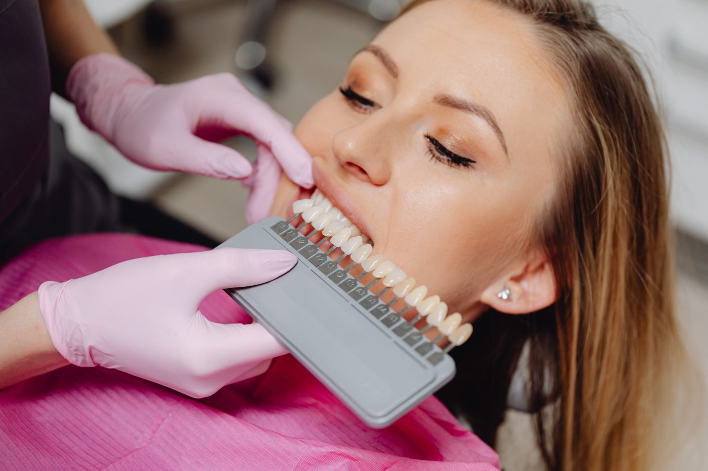 Dentist assessing a patient with a professional tooth shade guide