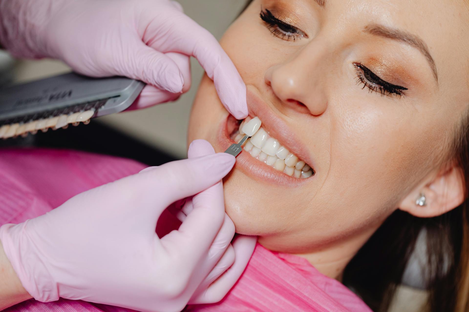 A Dentist Applying a Veneer Tooth on a Patient