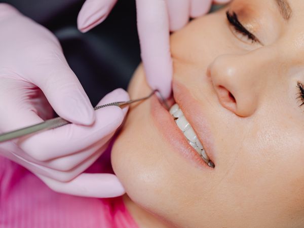 Close-up of a dental check-up procedure at Smile Point dental clinic