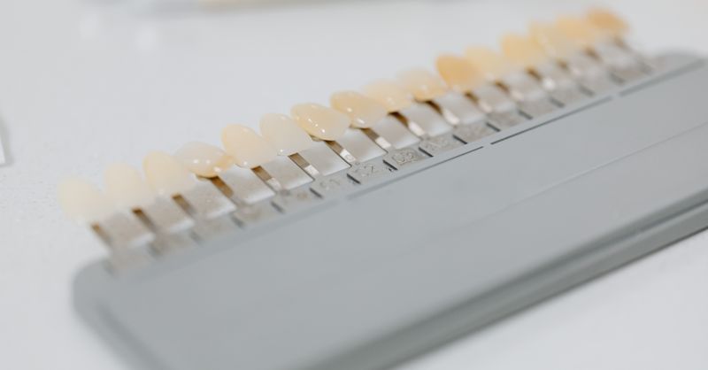 Belles Dents : 10 Conseils Dentiste 2026