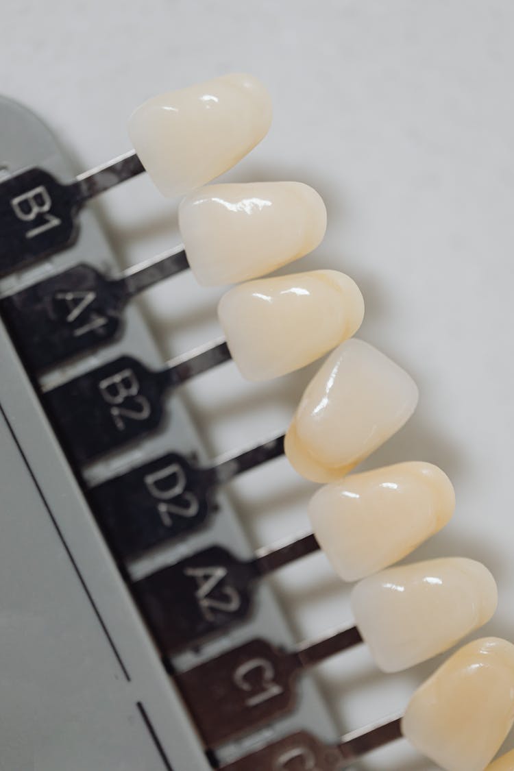 Close-up Of Teeth Veneers