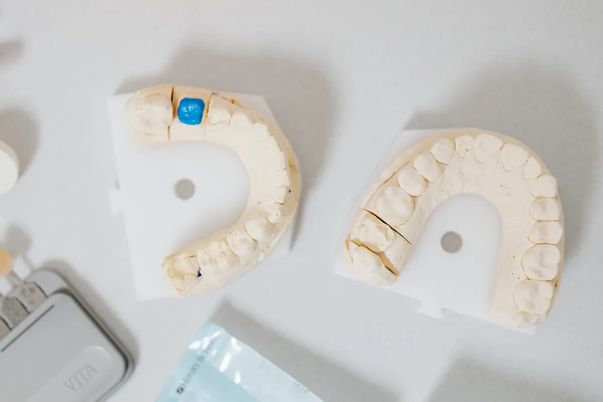 Zirconia crowns milled in-house