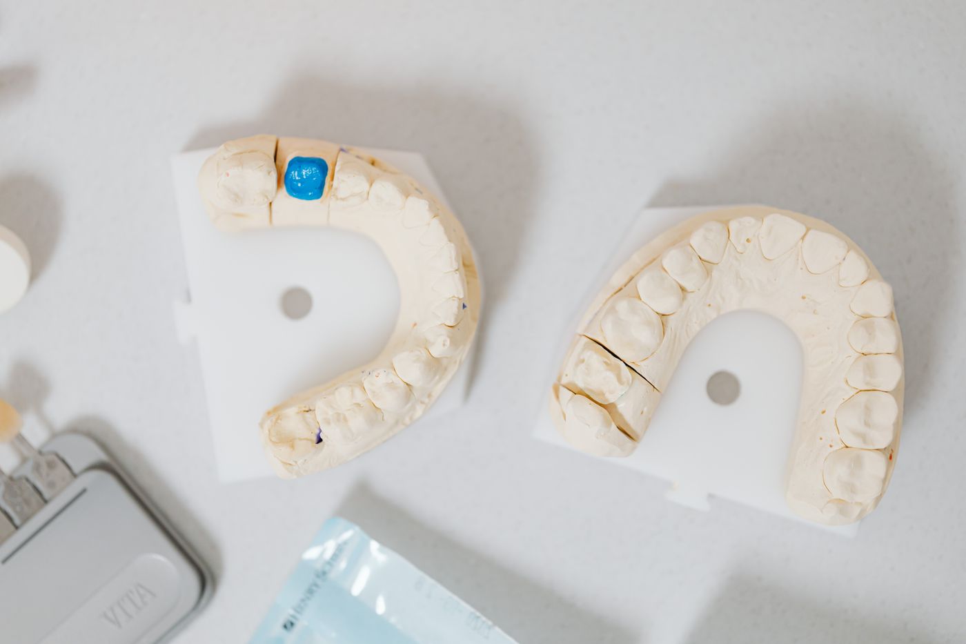 Dental casts used to create a custom night guard