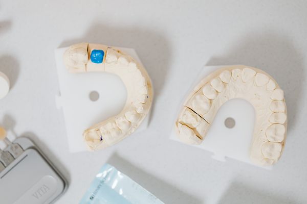Dental crowns and restorations