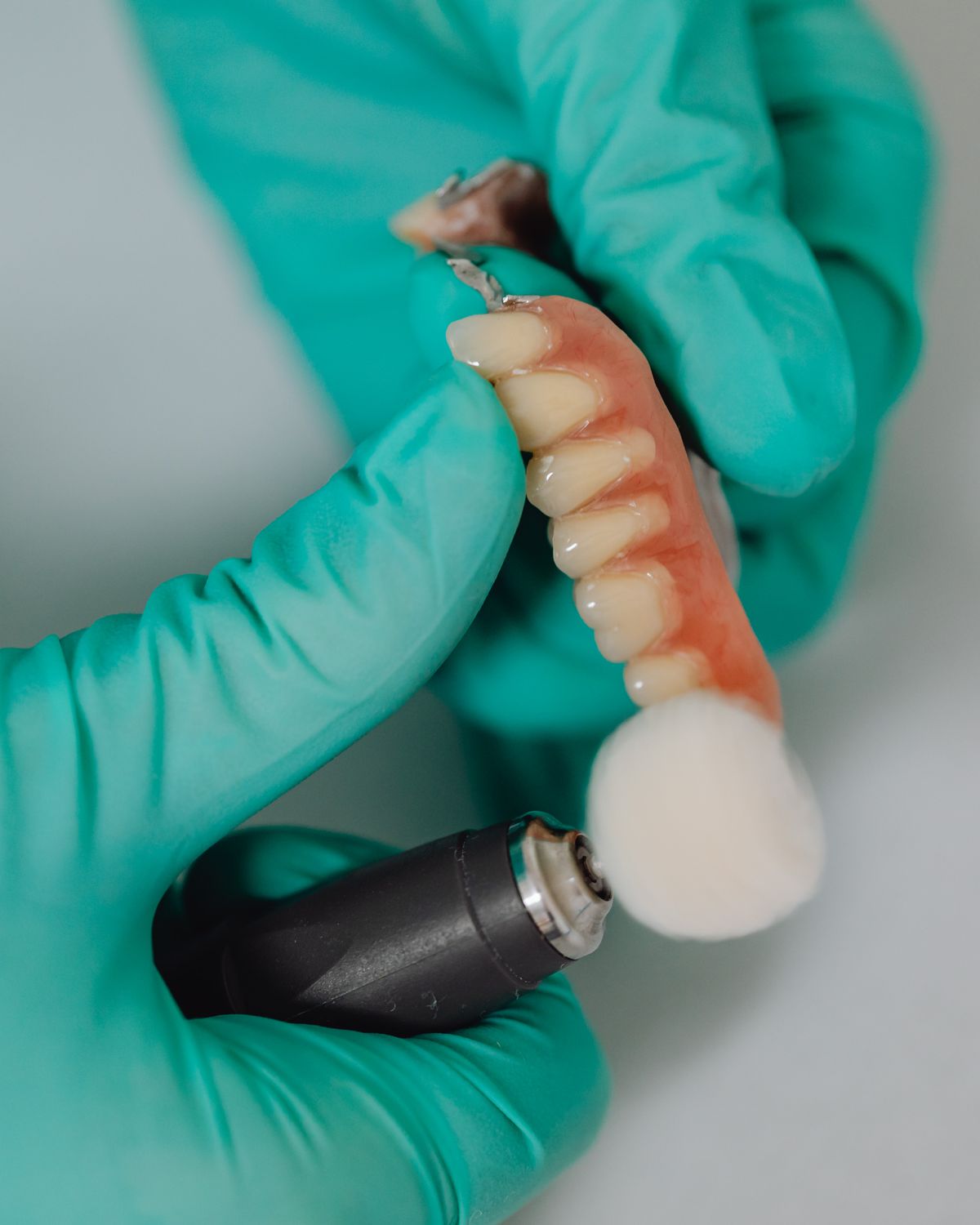 Implant Restorations