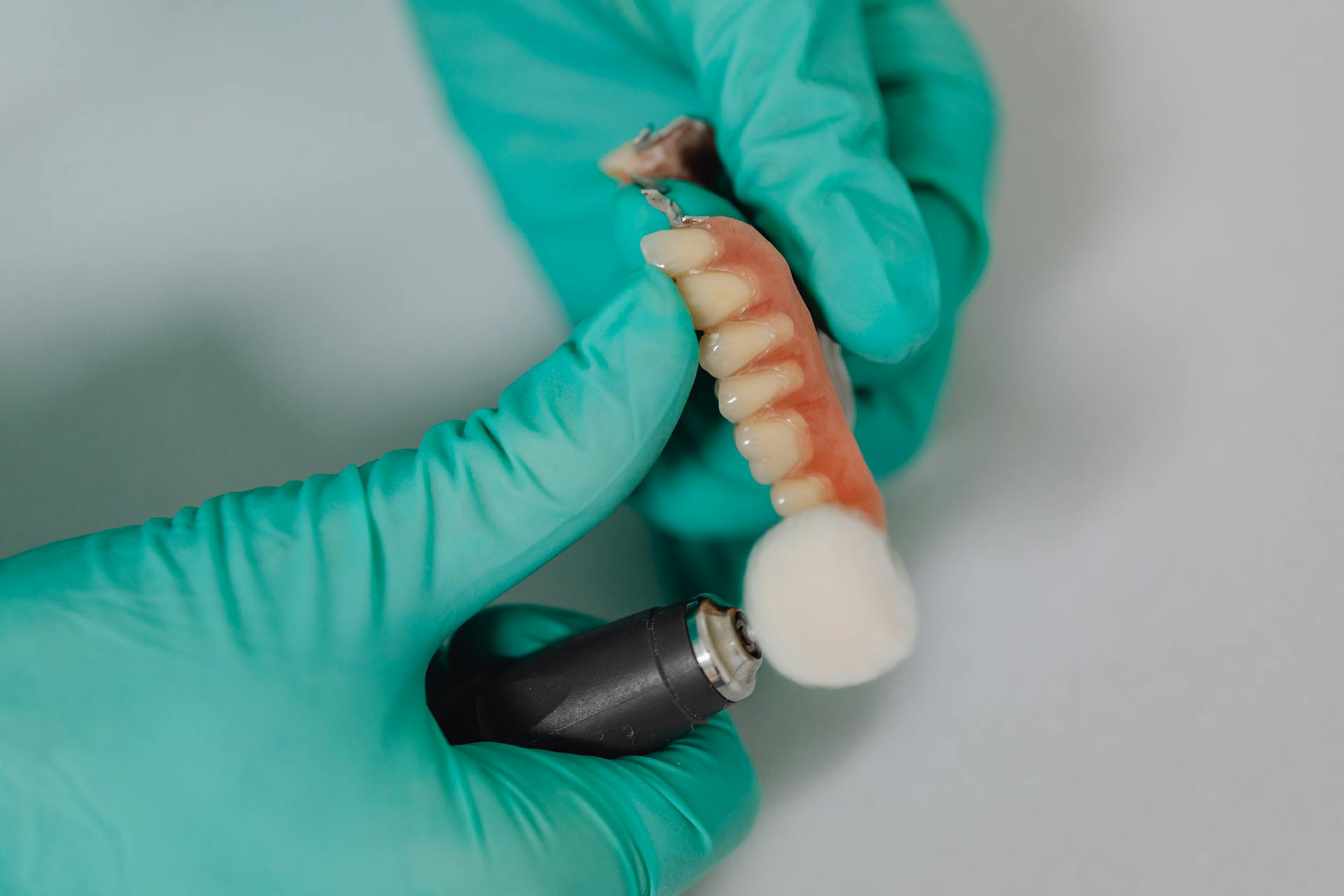 Person Hands Polishing Teeth Implants