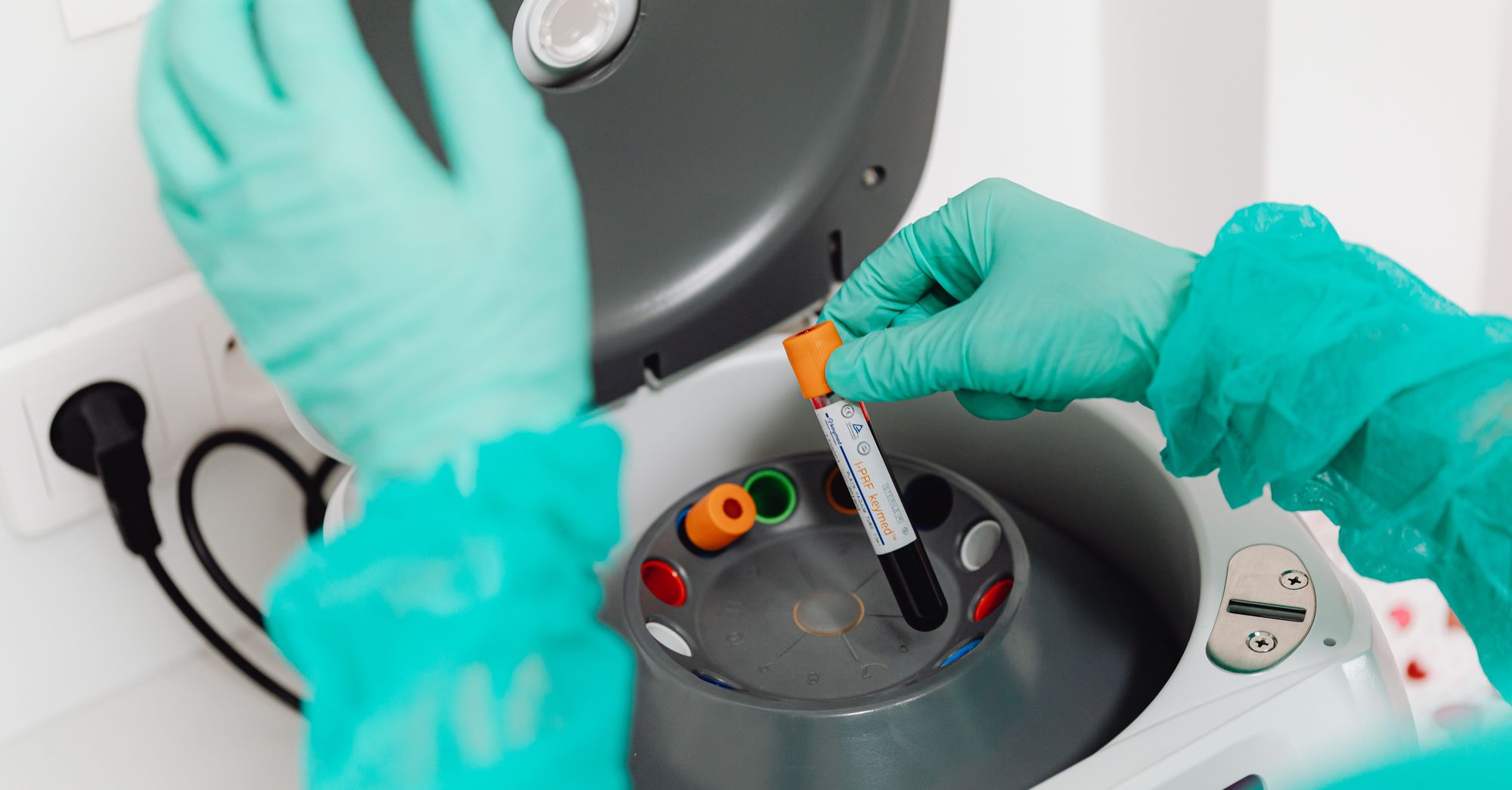 European STI Cases Surge, Stoking Antibiotic Resistance Fears