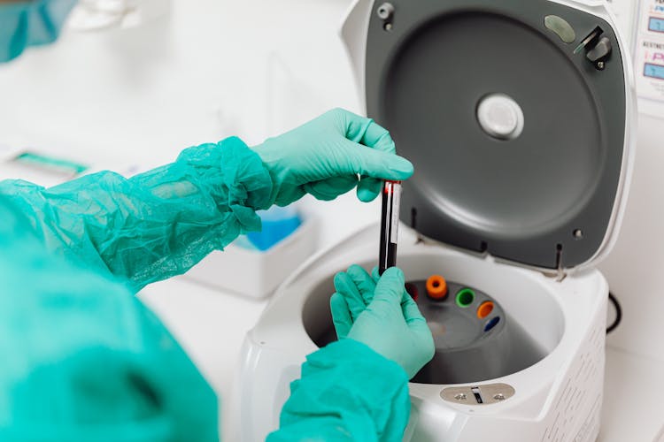 
A Person Wearing Latex Gloves Holding A Centrifuge Tube