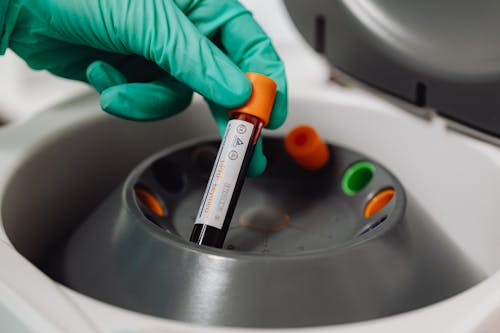 Close-up of a Doctor Holding a Tube with Blood 