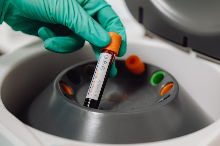 Close-up Of A Doctor Holding A Tube With Blood 