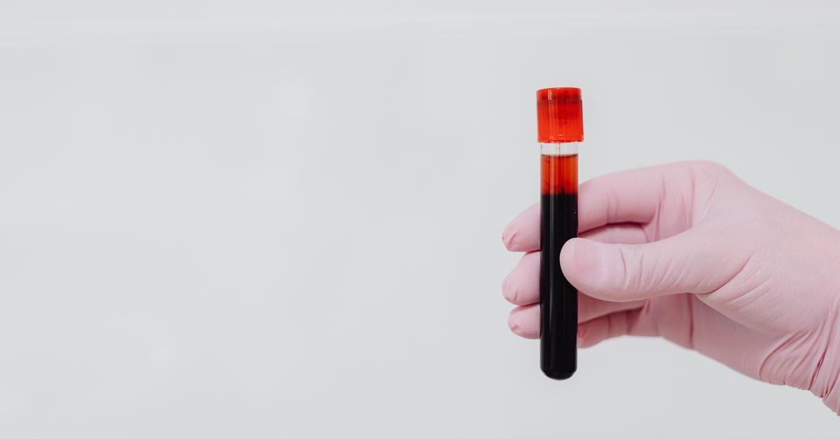 Molbio Diagnostics' IPO: A High-Risk Opportunity for Investors