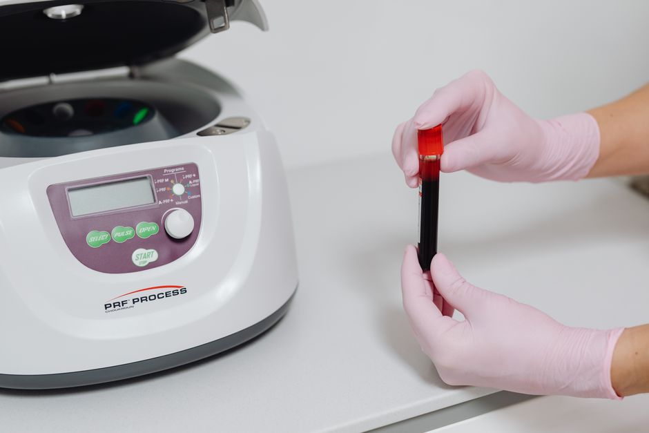 PRP para queda de cabelo: tratamento com plasma rico em plaquetas
