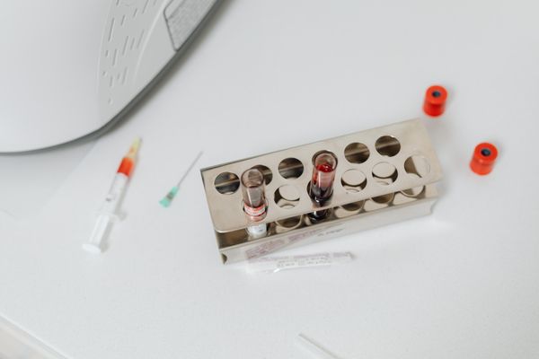 Test tubes in rack - specimen processing phases