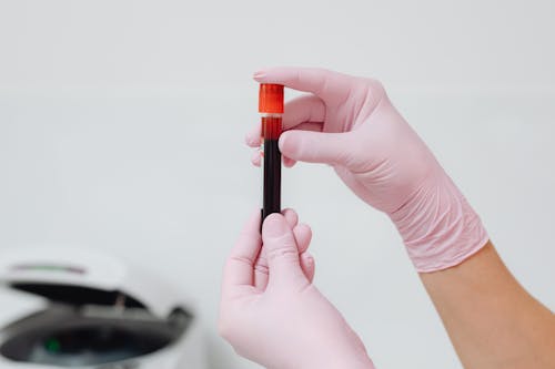 Hands of Person Holding a Glass Test Tube