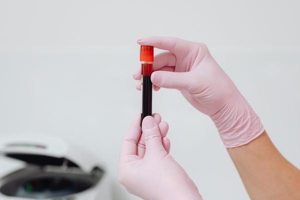 Hands holding a glass test tube with blood sample