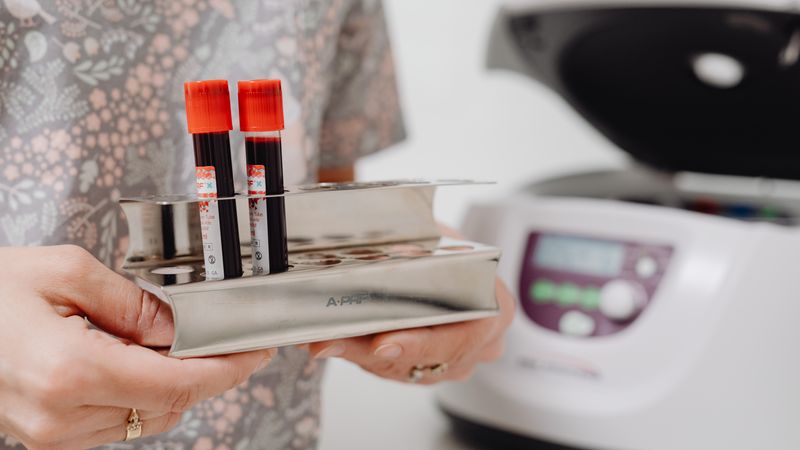 Close-up of blood vials in a laboratory setting, ready for testing.