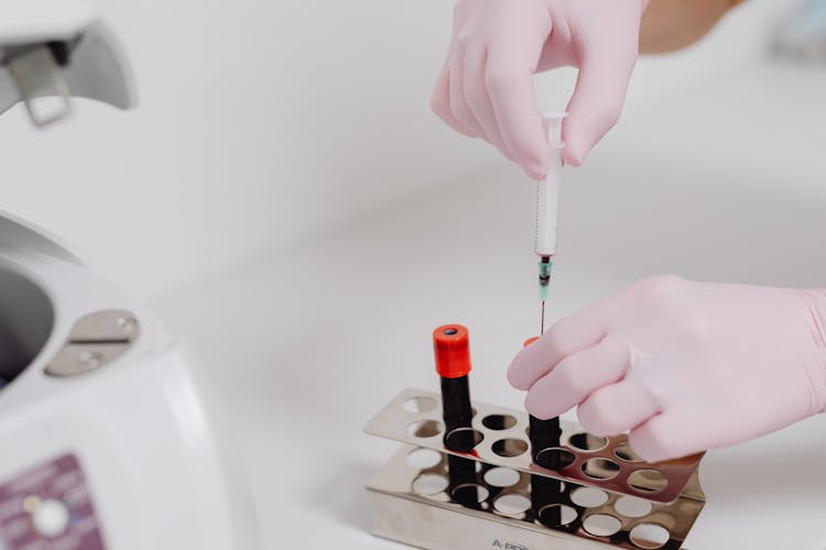 Hands In Gloves Working With Blood Samples