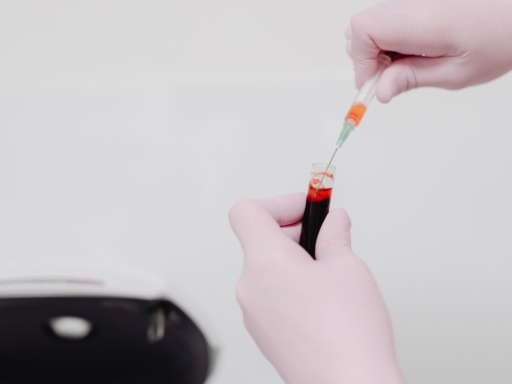 Lab technician handling a blood sample