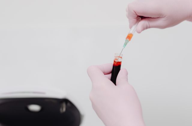 Lab technician handling a blood sample