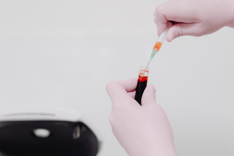 Close Up Of Nurse Hands Holding Medical Sample