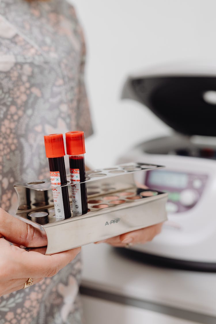 Nurse Holding Blood Vials