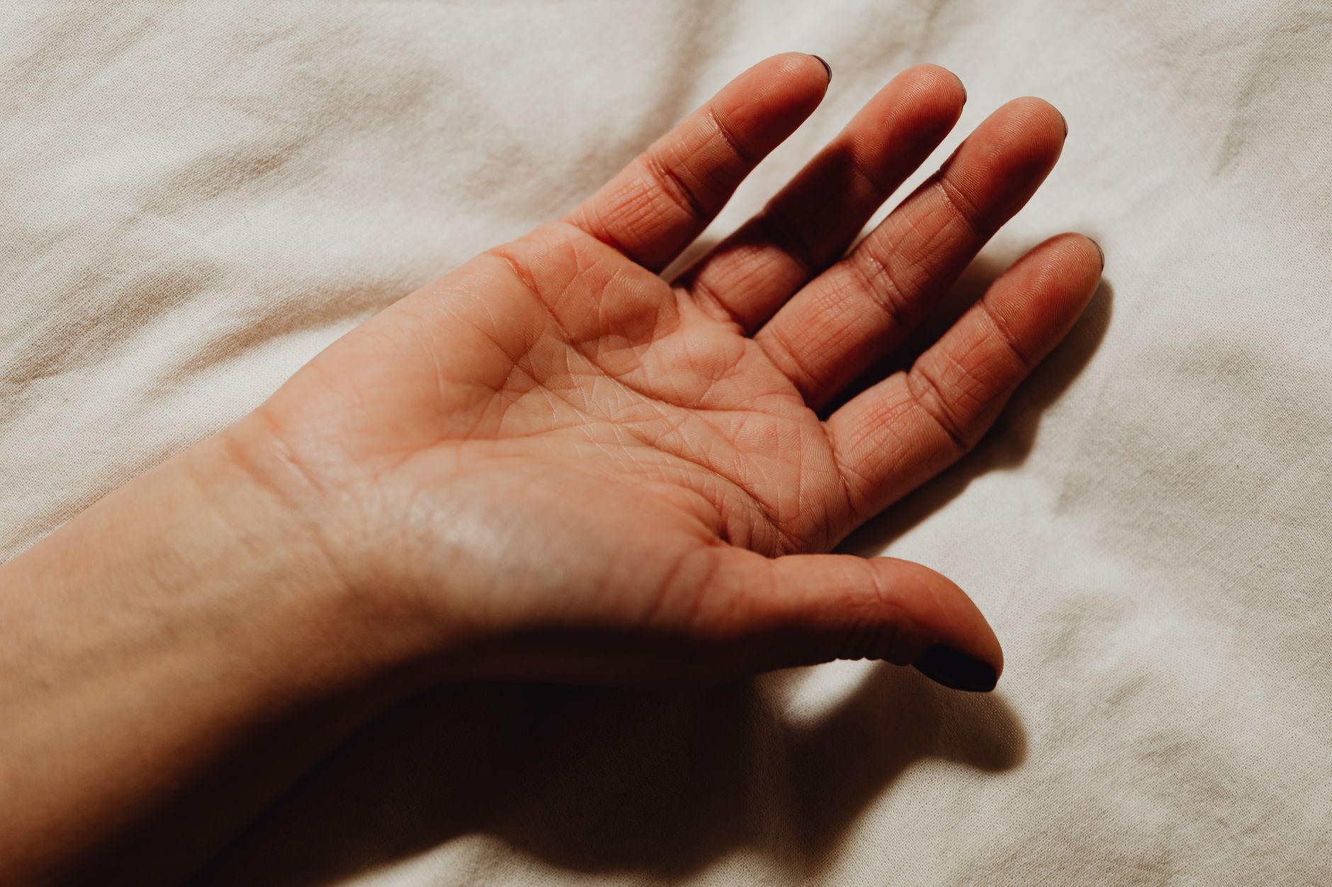 Eczema Blisters: Understanding Dyshidrotic Eczema and Its Management