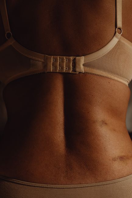 Close-up image of a woman's back showing skin texture and underwear detail.