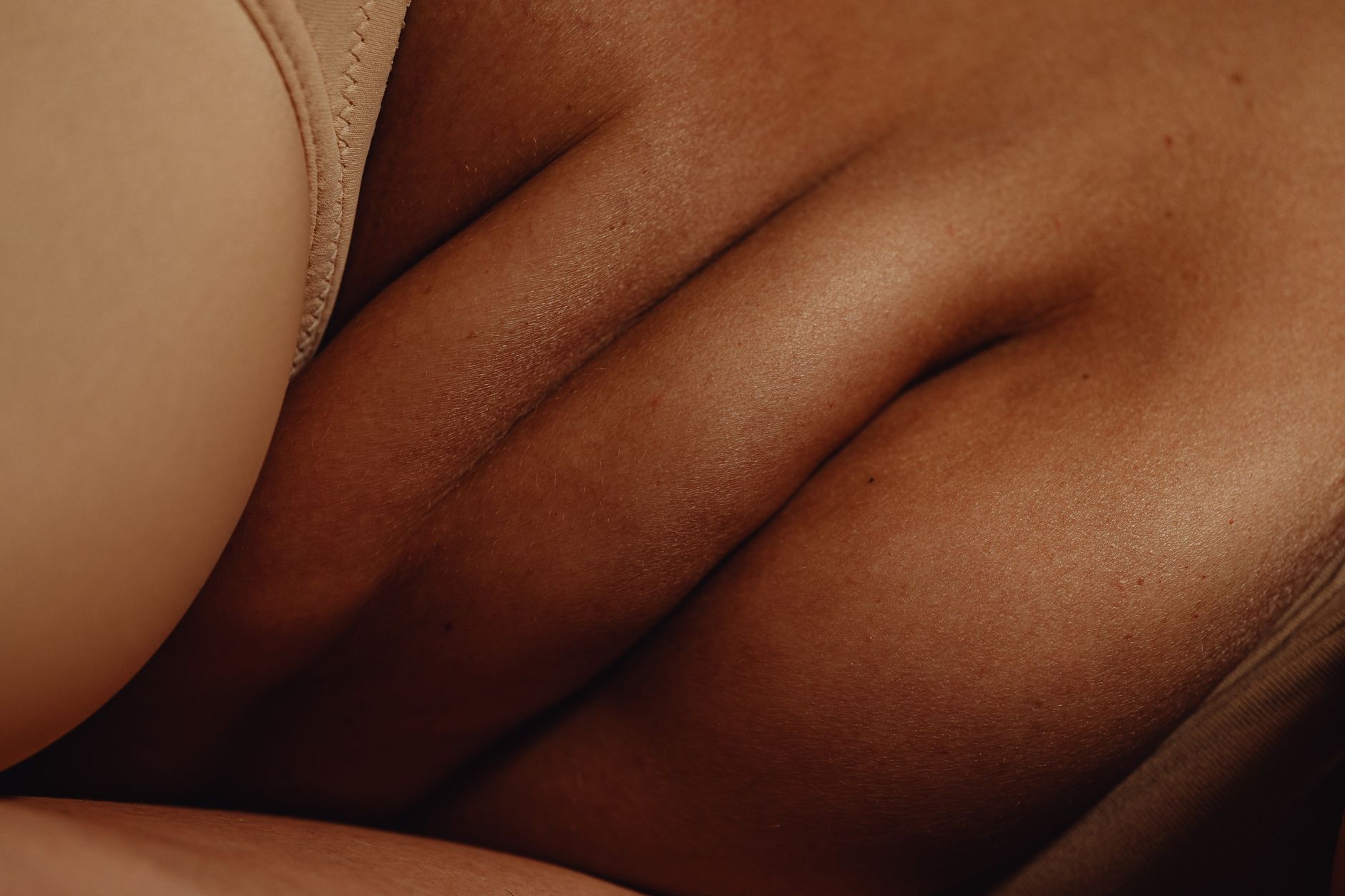 Cutaneous Endometriosis: Understanding This Rare Skin Condition