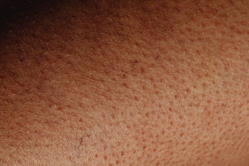 Close-up of Human Skin Texture