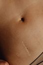 Persons Belly Button With Black Hair