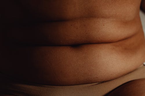 Free A Person's Belly With Folds Stock Photo