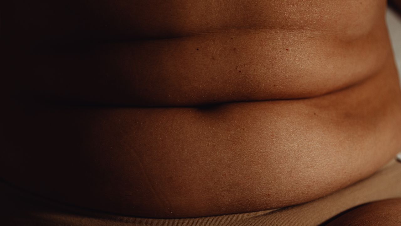 Lipo Corporal Enzimática em São Paulo: Durabilidade e Resultados Sustentáveis - Augusta Perfection