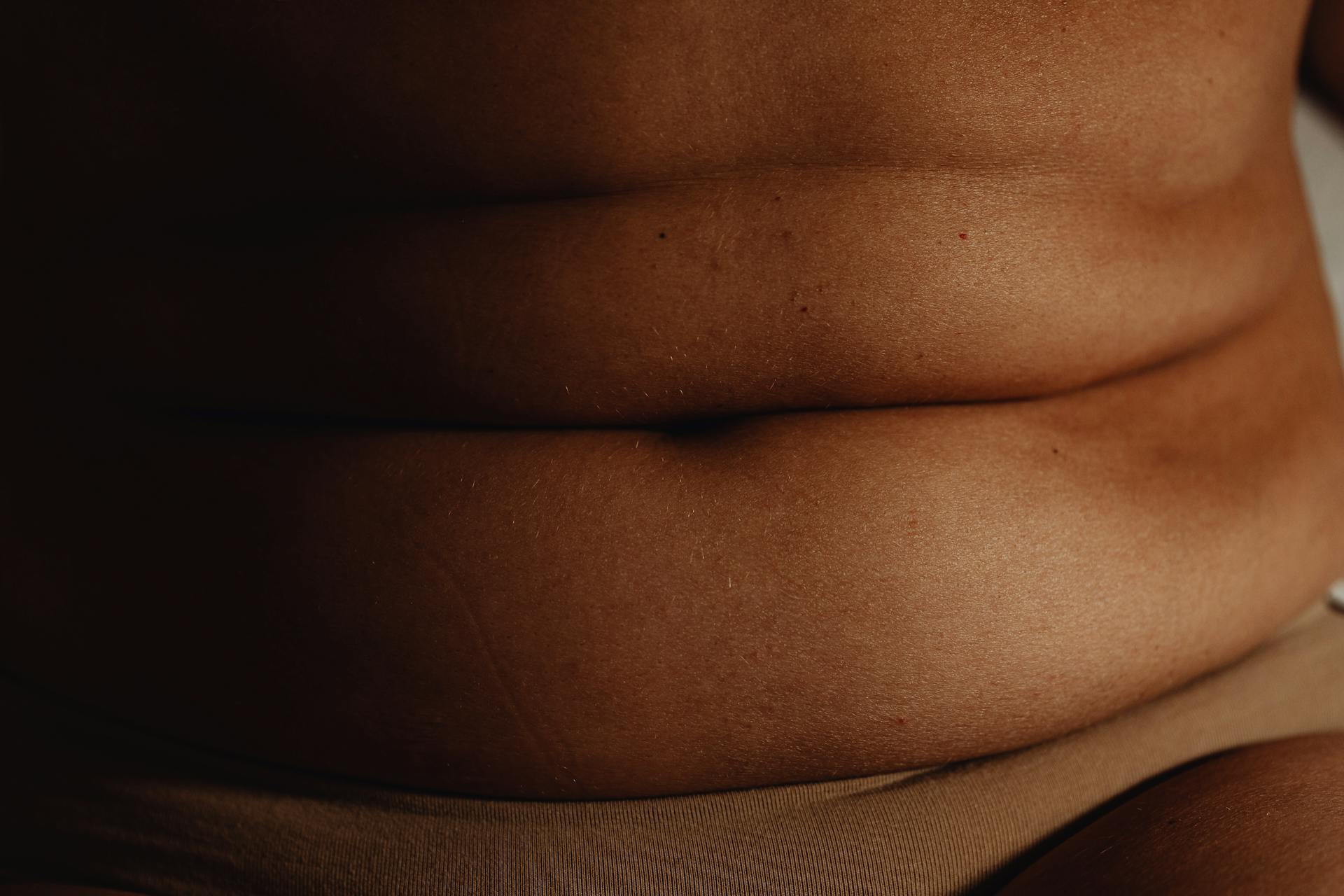 A Person's Belly With Folds