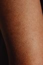 Free stock photo of abstract, adult, back