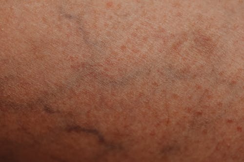 Close-up of Texture and Veins on Skin