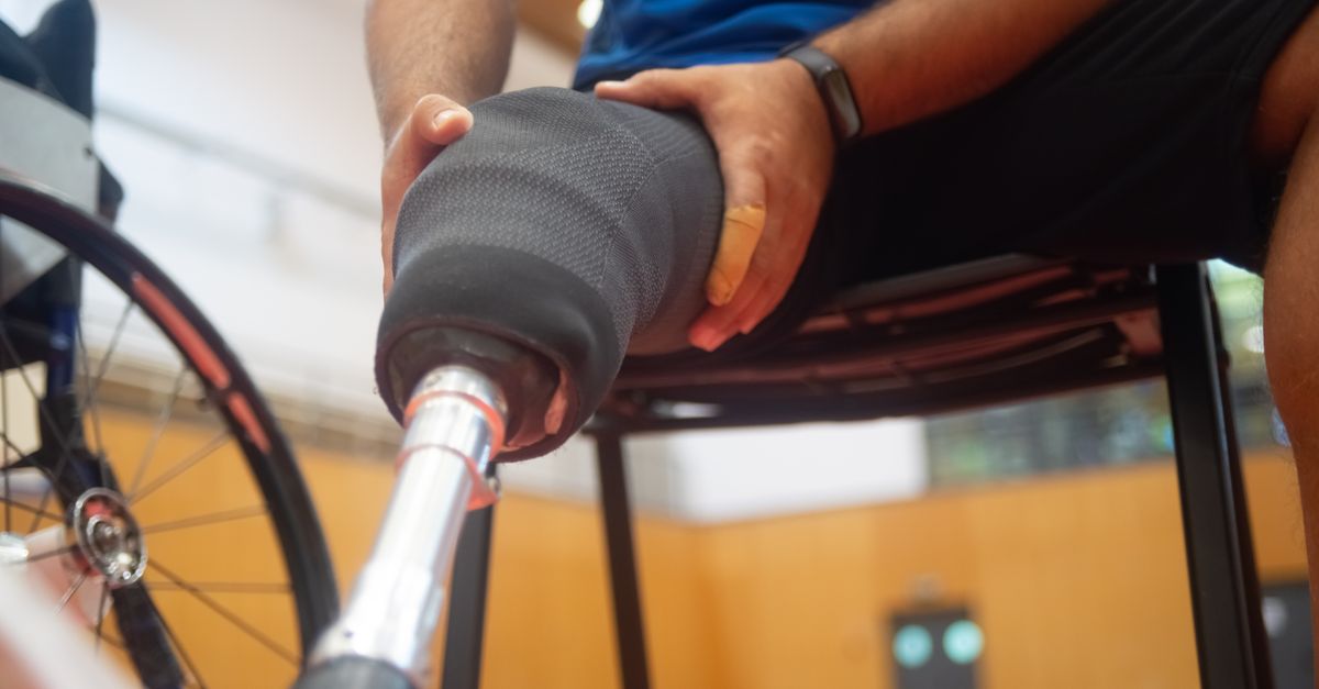 Close-up of a man adjusting his prosthetic leg while sitting indoors, emphasizing disability support.