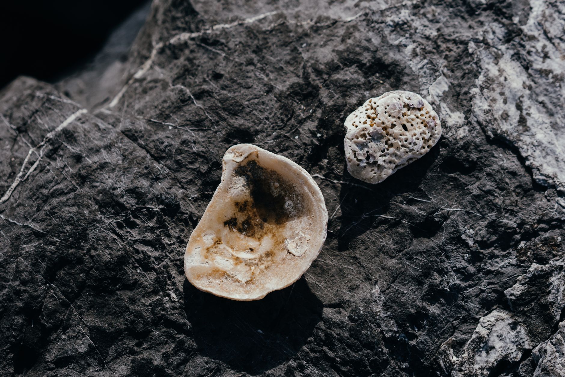 Tonsil Stones: Causes, Symptoms, Removal, and Prevention