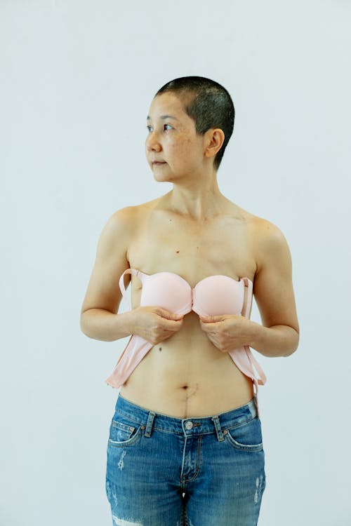 Thoughtful Asian woman in bra after breast removal surgery